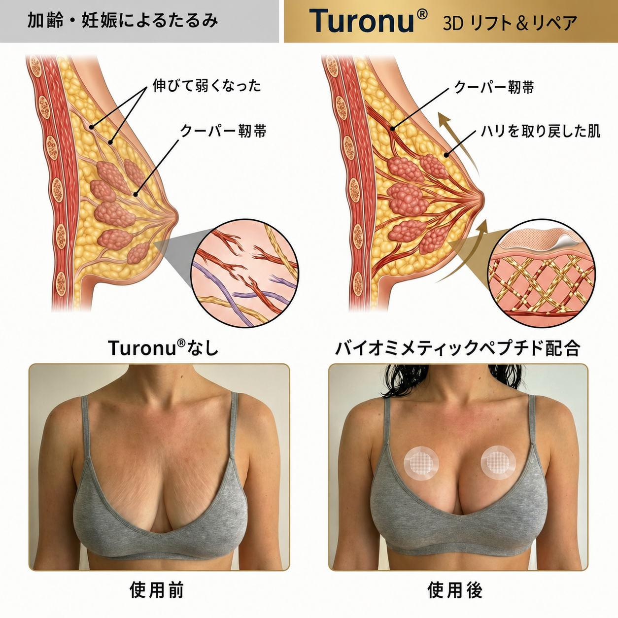 ✨Turonu® ☺️ 最先端ナノマイクロニードルパッチ｜理想のバストアップ集中ケア 🧪🇯🇵