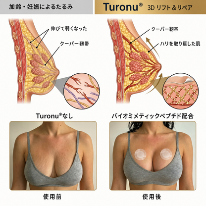 ✨Turonu® ☺️ 最先端ナノマイクロニードルパッチ｜理想のバストアップ集中ケア 🧪🇯🇵