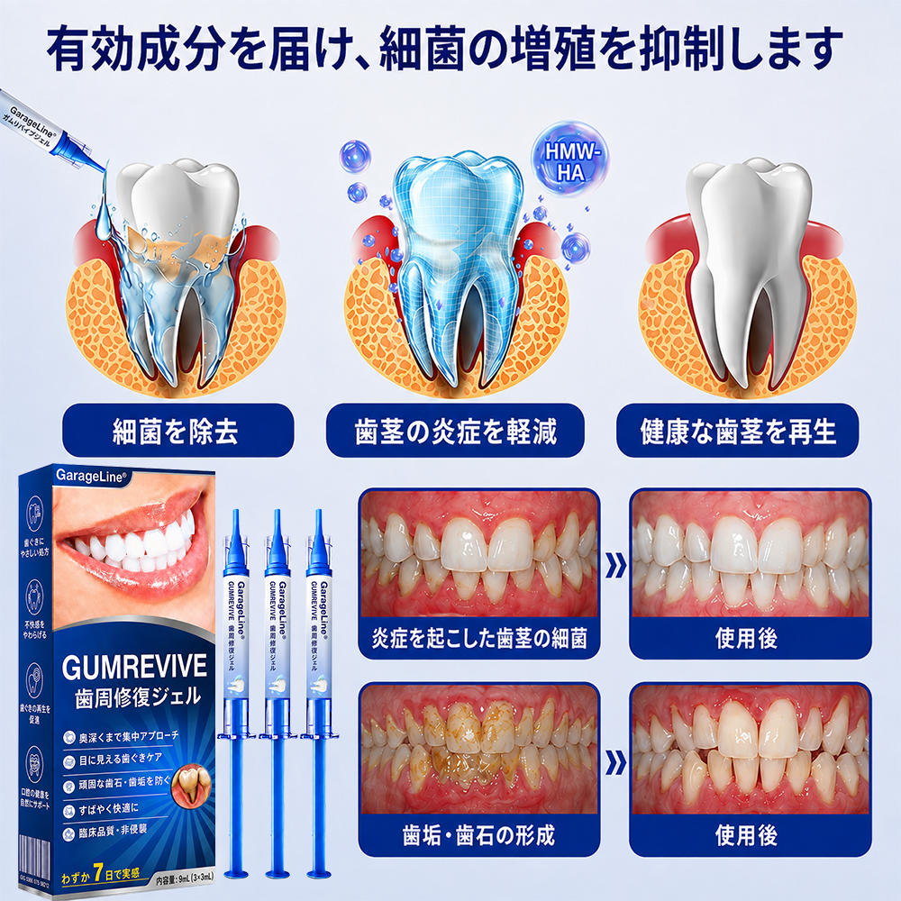 🇯🇵🎈GarageLine® GumRevive 歯茎のケアとより健康的な笑顔のための先進ジェル