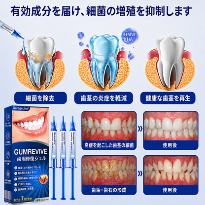 🇯🇵🎈GarageLine® GumRevive 歯茎のケアとより健康的な笑顔のための先進ジェル