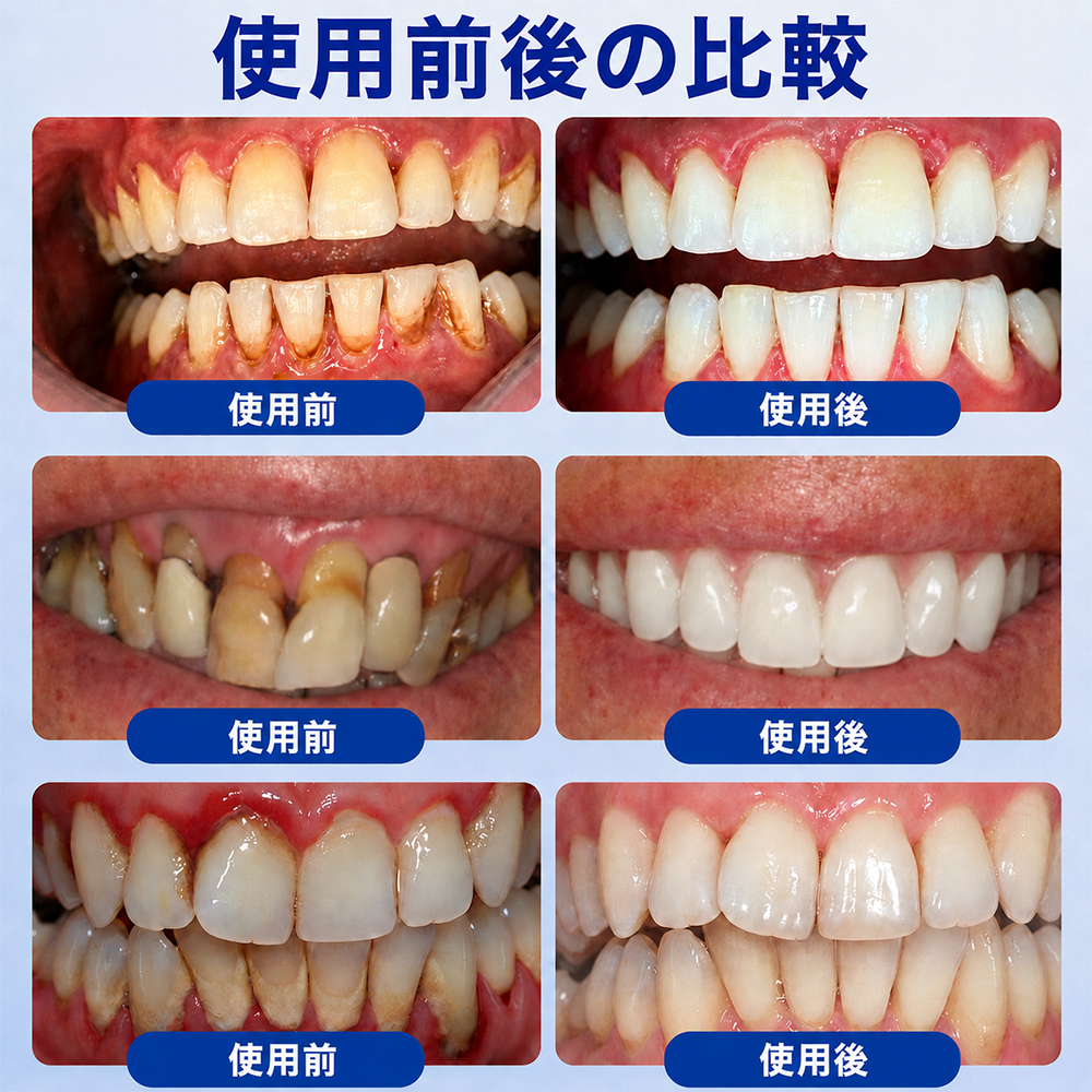 🇯🇵🎈GarageLine® GumRevive 歯茎のケアとより健康的な笑顔のための先進ジェル