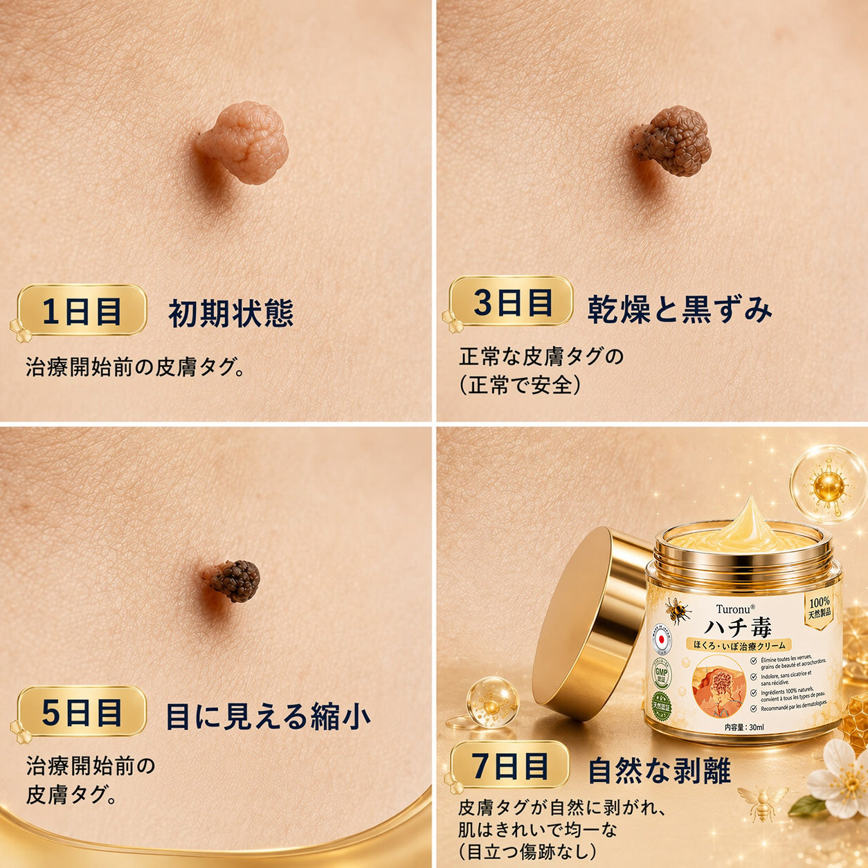 🐝 Turonu® 蜂毒配合の先進ケアクリーム｜イボ・肌の気になる部分へ 👨‍⚕️ 皮膚科学に着想を得た処方 | ご自宅でできる集中ケア🍯