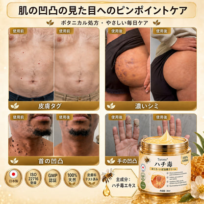 🐝 Turonu® 蜂毒配合の先進ケアクリーム｜イボ・肌の気になる部分へ 👨‍⚕️ 皮膚科学に着想を得た処方 | ご自宅でできる集中ケア🍯
