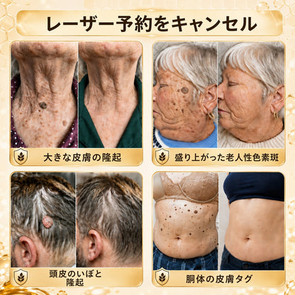 🐝 Turonu® 蜂毒配合の先進ケアクリーム｜イボ・肌の気になる部分へ 👨‍⚕️ 皮膚科学に着想を得た処方 | ご自宅でできる集中ケア🍯
