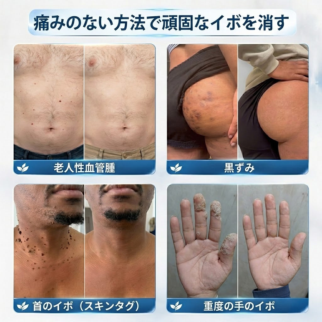 🎊国内品質基準の製造施設 7日間でスキンタグ・シミをケア 痛みが少なく、跡が残りにくい先進ロールオンペン